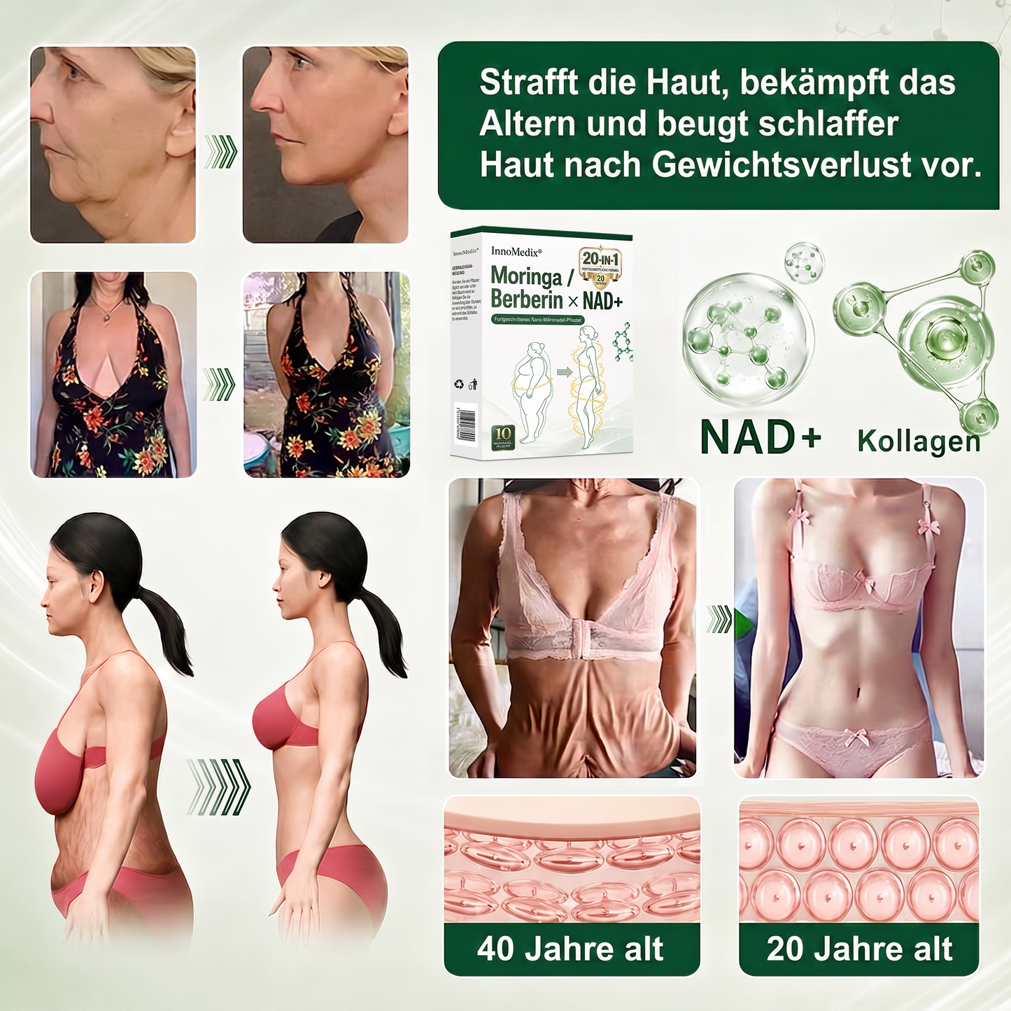 InnoMedix® Moringa Berberin x NAD+ 20-IN-1 Advanced Nano-Mikronadel-Pflaster(德国upsell)