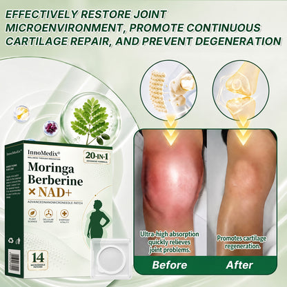 InnoMedix® Moringa · Berberine × NAD+ 20-IN-1 Advanced Nano Microneedle Patch（英国英语）