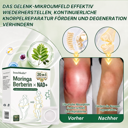 InnoMedix® Moringa Berberin x NAD+ 20-IN-1 Advanced Nano-Mikronadel-Pflaster(德国upsell)