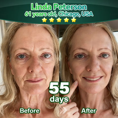 𝐎𝐟𝐟𝐢𝐜𝐢𝐚𝐥𝐥𝐲 𝐀𝐮𝐭𝐡𝐨𝐫𝐢𝐬𝐞𝐝 𝑬𝒙𝒄𝒍𝒖𝒔𝒊𝒗𝒆 𝑬𝒅𝒊𝒕𝒊𝒐𝒏✅|InnoMedix® 𝑆𝑡𝑒𝑚 𝐶𝑒𝑙𝑙 & 𝐶𝑜𝑙𝑙𝑎𝑔𝑒𝑛 𝑃𝑒𝑝𝑡𝑖𝑑𝑒 𝐷𝑟𝑜𝑝𝑠 (Lift & Firm Sagging Skin & Reduce Wrinkle Formation)🐦‍🔥
