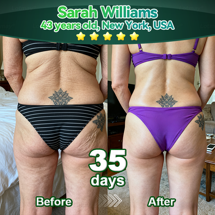 𝐎𝐟𝐟𝐢𝐜𝐢𝐚𝐥𝐥𝐲 𝐀𝐮𝐭𝐡𝐨𝐫𝐢𝐬𝐞𝐝 𝑬𝒙𝒄𝒍𝒖𝒔𝒊𝒗𝒆 𝑬𝒅𝒊𝒕𝒊𝒐𝒏✅|InnoMedix® 𝑆𝑡𝑒𝑚 𝐶𝑒𝑙𝑙 & 𝐶𝑜𝑙𝑙𝑎𝑔𝑒𝑛 𝑃𝑒𝑝𝑡𝑖𝑑𝑒 𝐷𝑟𝑜𝑝𝑠 (Lift & Firm Sagging Skin & Reduce Wrinkle Formation)🐦‍🔥