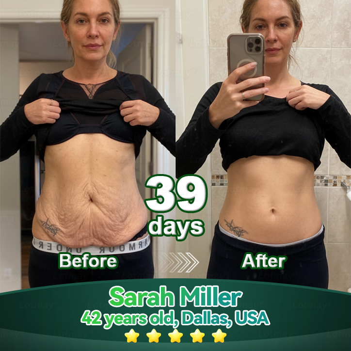 𝐎𝐟𝐟𝐢𝐜𝐢𝐚𝐥𝐥𝐲 𝐀𝐮𝐭𝐡𝐨𝐫𝐢𝐬𝐞𝐝 𝑬𝒙𝒄𝒍𝒖𝒔𝒊𝒗𝒆 𝑬𝒅𝒊𝒕𝒊𝒐𝒏✅|InnoMedix® 𝑆𝑡𝑒𝑚 𝐶𝑒𝑙𝑙 & 𝐶𝑜𝑙𝑙𝑎𝑔𝑒𝑛 𝑃𝑒𝑝𝑡𝑖𝑑𝑒 𝐷𝑟𝑜𝑝𝑠 (Lift & Firm Sagging Skin & Reduce Wrinkle Formation)🐦‍🔥
