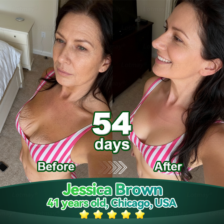 𝐎𝐟𝐟𝐢𝐜𝐢𝐚𝐥𝐥𝐲 𝐀𝐮𝐭𝐡𝐨𝐫𝐢𝐬𝐞𝐝 𝑬𝒙𝒄𝒍𝒖𝒔𝒊𝒗𝒆 𝑬𝒅𝒊𝒕𝒊𝒐𝒏✅|InnoMedix® 𝑆𝑡𝑒𝑚 𝐶𝑒𝑙𝑙 & 𝐶𝑜𝑙𝑙𝑎𝑔𝑒𝑛 𝑃𝑒𝑝𝑡𝑖𝑑𝑒 𝐷𝑟𝑜𝑝𝑠 (Lift & Firm Sagging Skin & Reduce Wrinkle Formation)🐦‍🔥