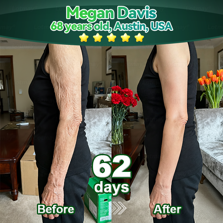 𝐎𝐟𝐟𝐢𝐜𝐢𝐚𝐥𝐥𝐲 𝐀𝐮𝐭𝐡𝐨𝐫𝐢𝐬𝐞𝐝 𝑬𝒙𝒄𝒍𝒖𝒔𝒊𝒗𝒆 𝑬𝒅𝒊𝒕𝒊𝒐𝒏✅|InnoMedix® 𝑆𝑡𝑒𝑚 𝐶𝑒𝑙𝑙 & 𝐶𝑜𝑙𝑙𝑎𝑔𝑒𝑛 𝑃𝑒𝑝𝑡𝑖𝑑𝑒 𝐷𝑟𝑜𝑝𝑠 (Lift & Firm Sagging Skin & Reduce Wrinkle Formation)🐦‍🔥