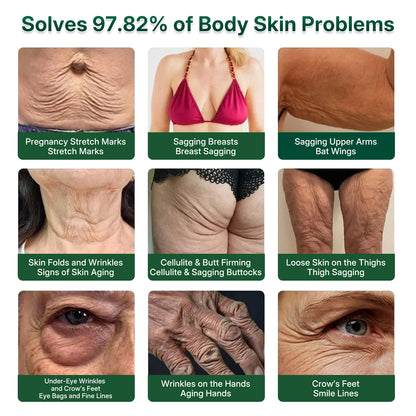 InnoMedix® 🧬𝑷𝑫𝑹𝑵 𝑨𝒏𝒕𝒊-𝑨𝒈𝒊𝒏𝒈 & 𝑻𝒂𝒓𝒈𝒆𝒕𝒆𝒅 𝑺𝒌𝒊𝒏 𝑹𝒆𝒏𝒆𝒘𝒂𝒍 𝑺𝒕𝒊𝒄𝒌 (𝑯𝒆𝒍𝒑𝒔 𝒗𝒊𝒔𝒊𝒃𝒍𝒚 𝒔𝒎𝒐𝒐𝒕𝒉 𝒘𝒓𝒊𝒏𝒌𝒍𝒆𝒔, 𝒔𝒖𝒑𝒑𝒐𝒓𝒕𝒔 𝒂 𝒇𝒊𝒓𝒎𝒆𝒓-𝒍𝒐𝒐𝒌𝒊𝒏𝒈 𝒔𝒌𝒊𝒏 𝒂𝒑𝒑𝒆𝒂𝒓𝒂𝒏𝒄𝒆 & 𝒊𝒎𝒑𝒓𝒐𝒗𝒆𝒔 𝒕𝒉𝒆 𝒂𝒑𝒑𝒆𝒂𝒓𝒂𝒏𝒄𝒆 𝒐𝒇 𝒗𝒊𝒔𝒊𝒃𝒍𝒆 𝒔𝒌𝒊𝒏 𝒔𝒑𝒐𝒕𝒔)