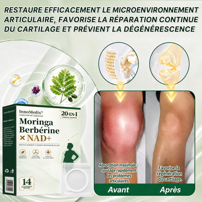 InnoMedix® Moringa Berbérine x NAD+ 20-IN-1 Patch Avancé à Nano-Microaiguilles (À appliquer une seule fois par jour – des changements visibles en seulement 7 jours.)（法国法语）（副本）