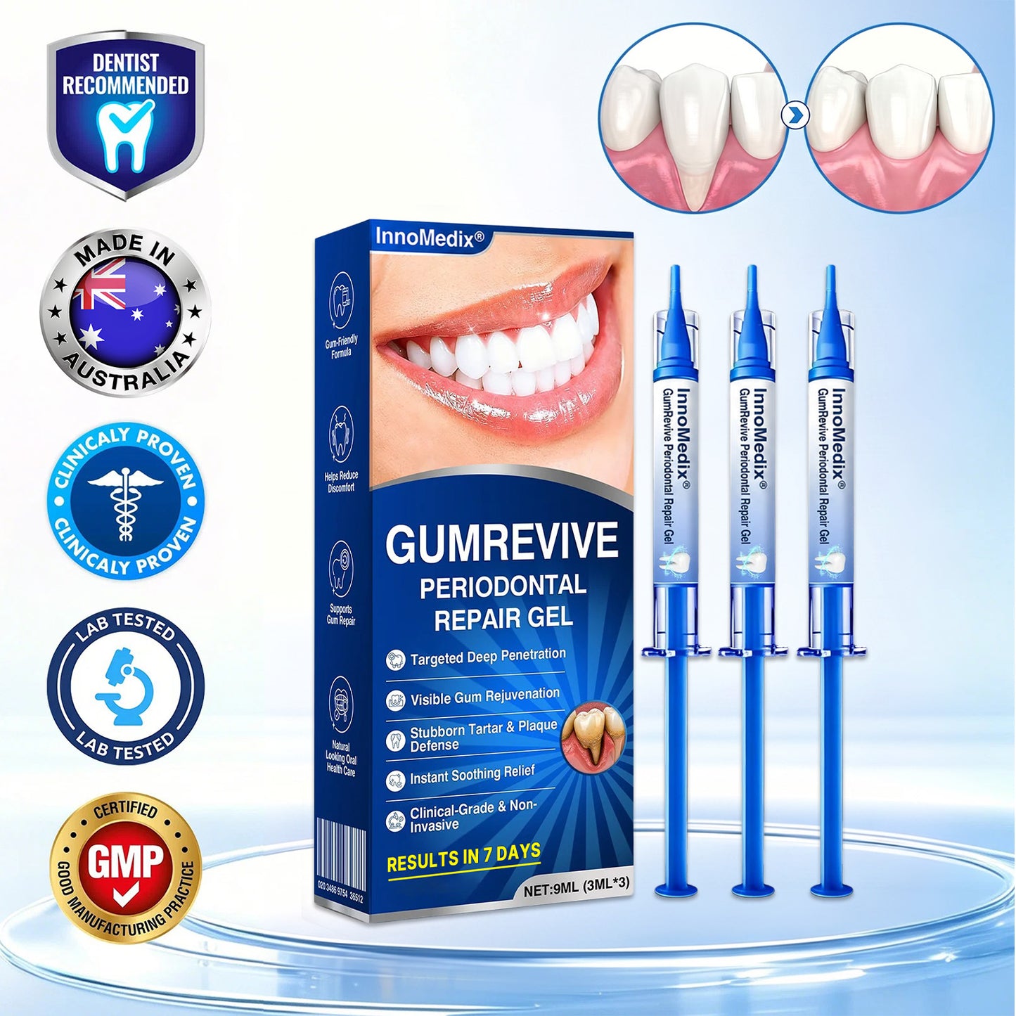 🇦🇺🏅🦷🛡️InnoMedix® GumRevive Periodontal Repair Gel（澳洲）
