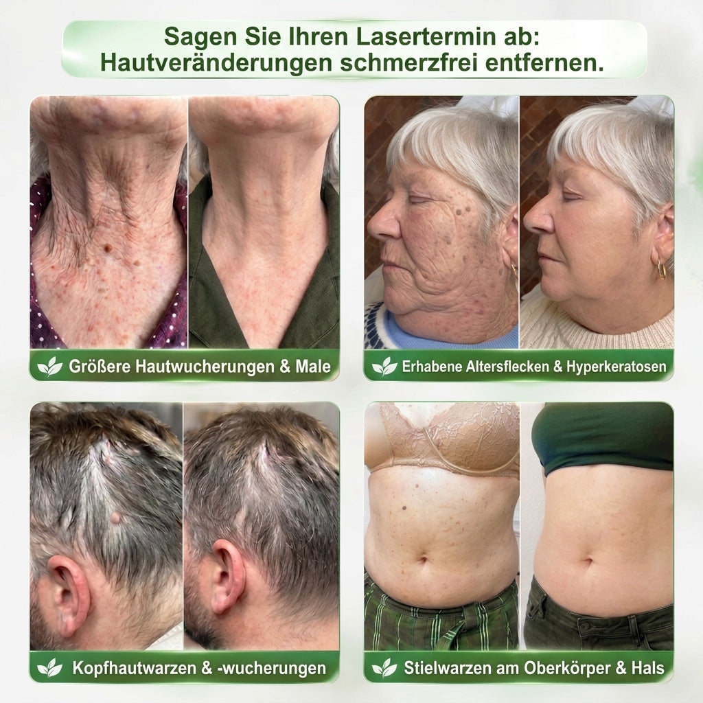 InnoMedix® 🧬𝑷𝑫𝑹𝑵 𝑨𝒏𝒕𝒊-𝑨𝒈𝒊𝒏𝒈 & 𝒈𝒆𝒛𝒊𝒆𝒍𝒕𝒆𝒓 𝑯𝒂𝒖𝒕𝒆𝒓𝒏𝒆𝒖𝒆𝒓𝒖𝒏𝒈𝒔-𝑺𝒕𝒊𝒄𝒌（𝑯𝒊𝒍𝒇𝒕, 𝑭𝒂𝒍𝒕𝒆𝒏 𝒔𝒊𝒄𝒉𝒕𝒃𝒂𝒓 𝒛𝒖 𝒈𝒍ä𝒕𝒕𝒆𝒏, 𝒖𝒏𝒕𝒆𝒓𝒔𝒕ü𝒕𝒛𝒕 𝒆𝒊𝒏 𝒔𝒕𝒓𝒂𝒇𝒇𝒆𝒓 𝒘𝒊𝒓𝒌𝒆𝒏𝒅𝒆𝒔 𝑯𝒂𝒖𝒕𝒃𝒊𝒍𝒅 𝒖𝒏𝒅 𝒗𝒆𝒓𝒃𝒆𝒔𝒔𝒆𝒓𝒕 𝒅𝒂𝒔 𝑬𝒓𝒔𝒄𝒉𝒆𝒊𝒏𝒖𝒏𝒈𝒔𝒃𝒊𝒍𝒅 𝒔𝒊𝒄𝒉𝒕𝒃𝒂𝒓𝒆𝒓 𝑯𝒂𝒖𝒕𝒇𝒍𝒆𝒄𝒌𝒆𝒏）（副本）