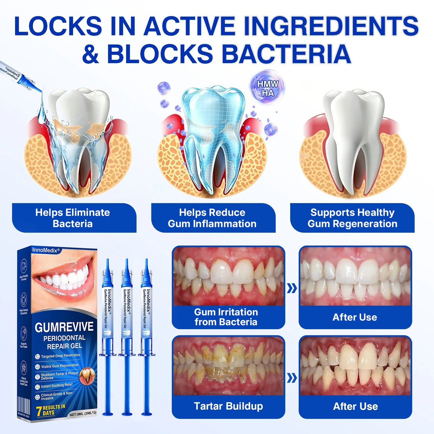 🇺🇸🏅🦷🛡️InnoMedix® GumRevive Periodontal Repair Gel（美国英语）