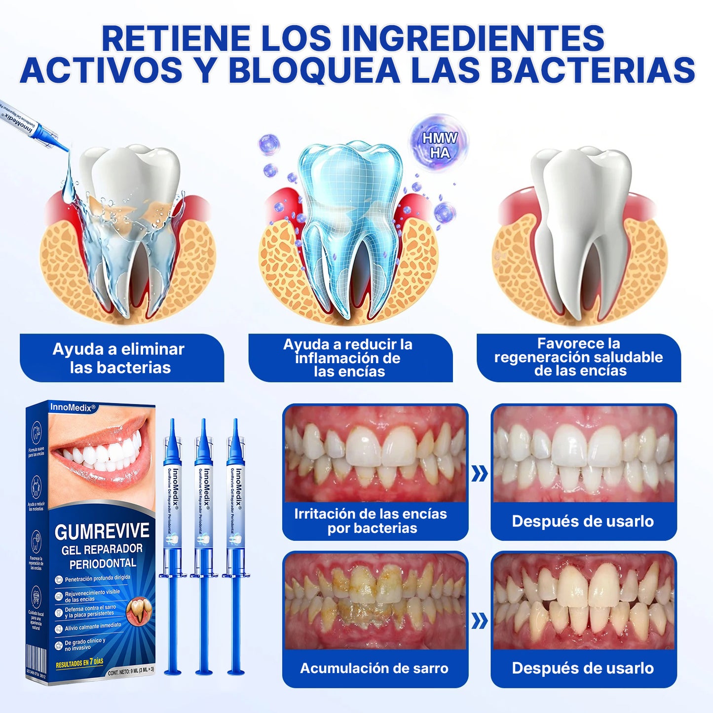 🇲🇽🏅🦷🛡️InnoMedix® Revitaliza Encías Gel Reparador Periodontal（墨西哥西语）