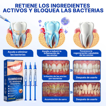 🇲🇽🏅🦷🛡️InnoMedix® Revitaliza Encías Gel Reparador Periodontal（墨西哥西语）