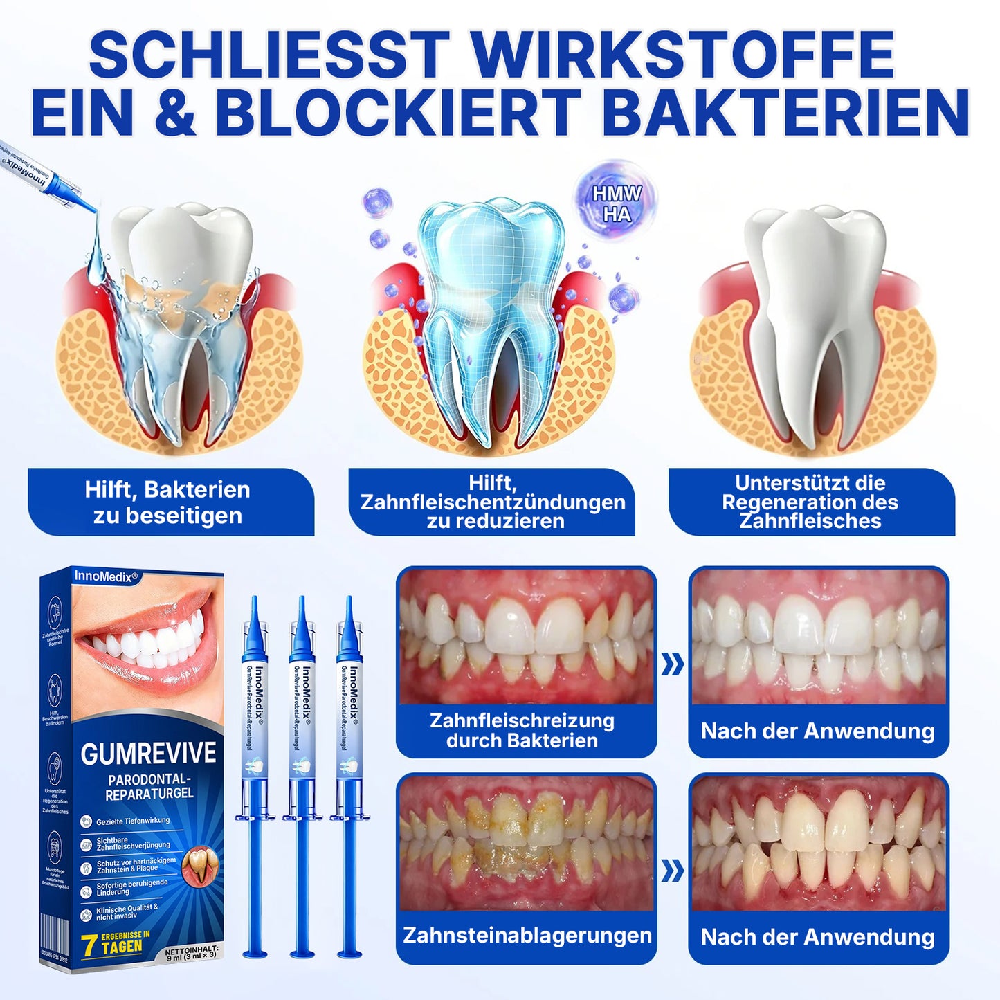 🇩🇪🏅🦷🛡️InnoMedix® Zahnfleisch-Regeneration Parodontal-Reparaturgel（德国）