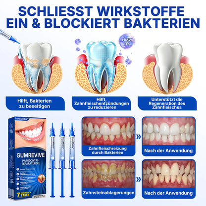 🇩🇪🏅🦷🛡️InnoMedix® Zahnfleisch-Regeneration Parodontal-Reparaturgel（德国）
