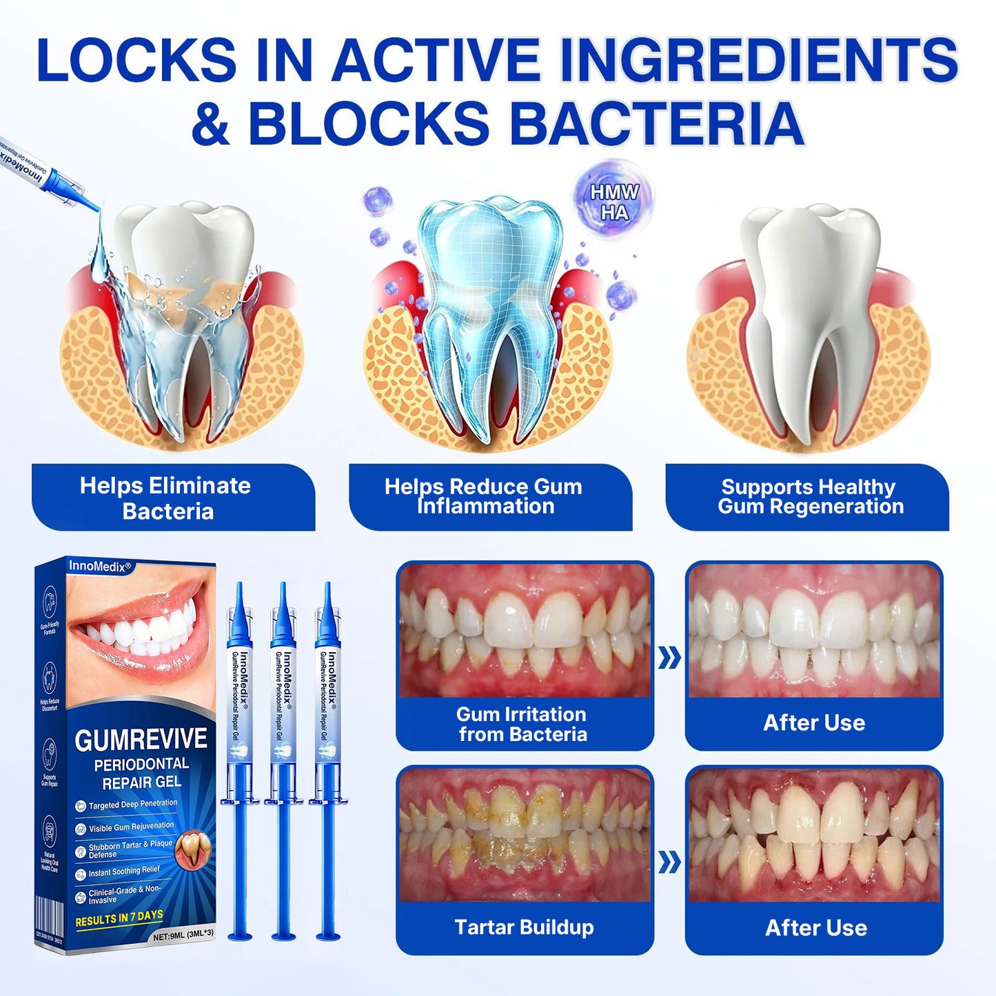 🇦🇺🏅🦷🛡️InnoMedix® GumRevive Periodontal Repair Gel（澳洲）