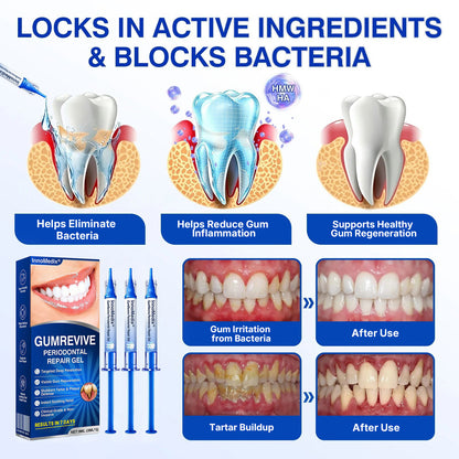 🇦🇺🏅🦷🛡️InnoMedix® GumRevive Periodontal Repair Gel（澳洲）