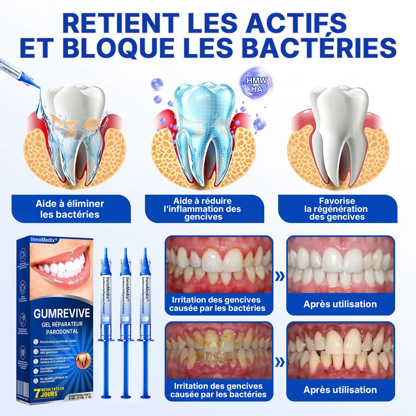 🇫🇷🏅🦷🛡️InnoMedix® Revitalisation des Gencives Gel Réparateur Parodontal（法国）