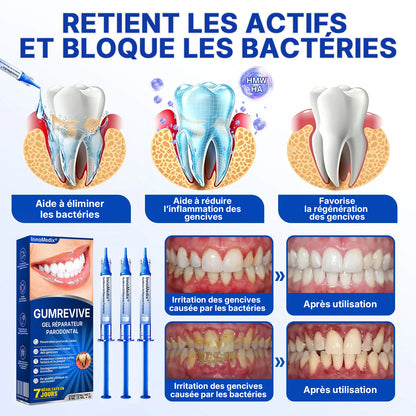 🇫🇷🏅🦷🛡️InnoMedix® Revitalisation des Gencives Gel Réparateur Parodontal（法国）