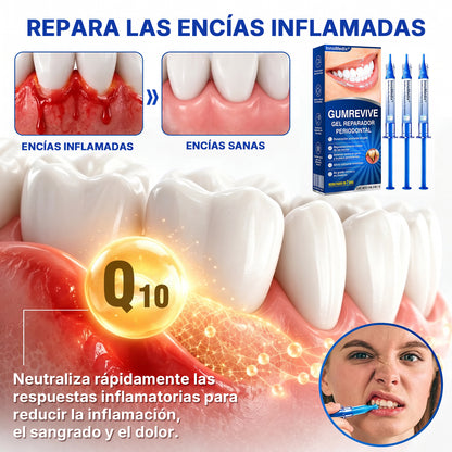 🇲🇽🏅🦷🛡️InnoMedix® Revitaliza Encías Gel Reparador Periodontal（墨西哥西语）