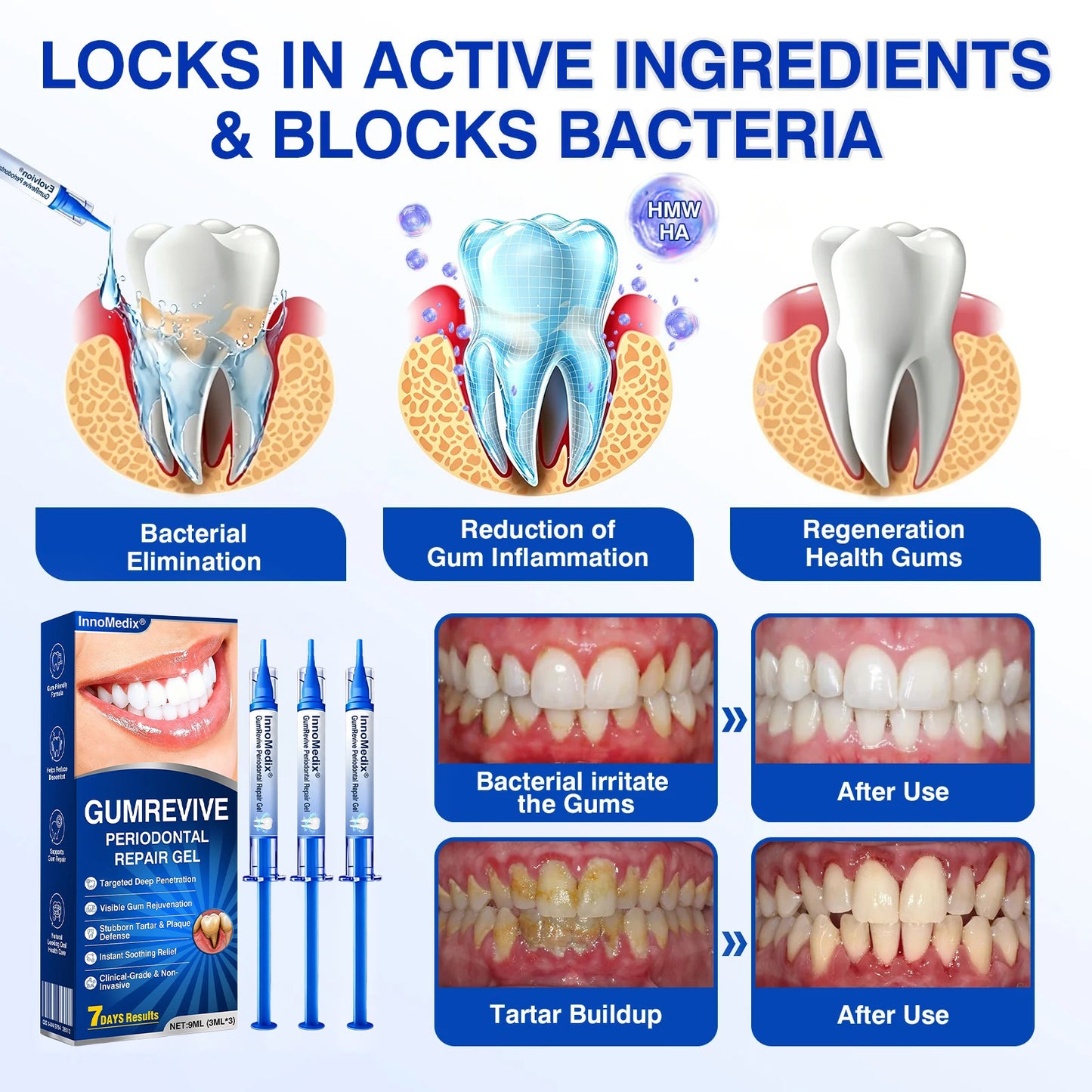🇬🇧🏅🦷🛡️InnoMedix® GumRevive Periodontal Repair Gel