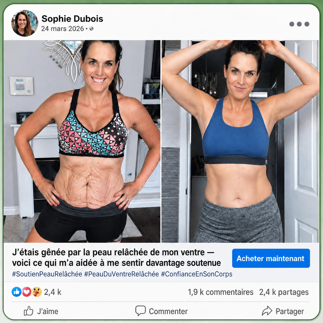 InnoMedix® Moringa Berbérine x NAD+ 20-IN-1 Patch Avancé à Nano-Microaiguilles (加拿大法语upsell）