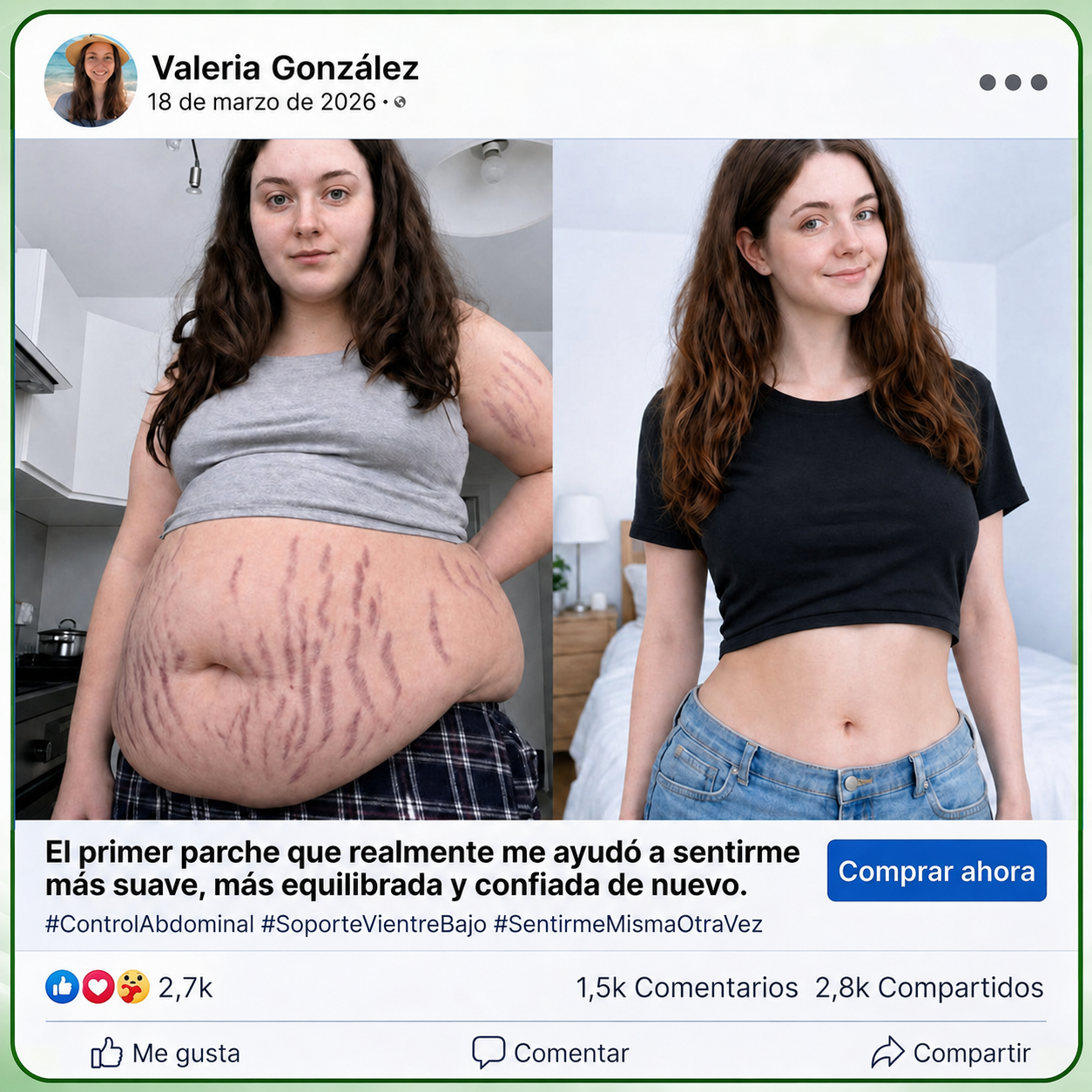 InnoMedix® Moringa Berberina x NAD+ 20-EN-1 Parche Avanzado de Nano-Microagujas (Aplicar solo una vez al día – cambios visibles en tan solo 7 días.)（墨西哥西语）