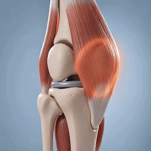 🔥 Healrize® Crema para el Confort Articular con Veneno de Abeja – Alivio Rápido para Hombros, Manos, Espalda y Articulaciones | Muévete con Mayor Libertad（美国西语）